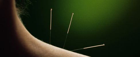 Call us to make an acupuncture appointment